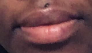 SERVE® LIP BLEACHING BALM