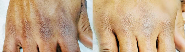 POWERFUL® Dark Knuckle Remover
